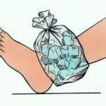 Первая помощь при ушибах и кровотечении