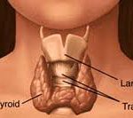 Если «барахлит» щитовидка
