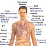 Бледная немочь. Что это за болезнь такая?