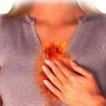 Изжога: досадная мелочь или серьезная проблема