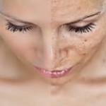 Рецепт очень эффективной маски от любых пятен на лице