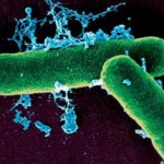 12 случаев сибирской язвы зарегистрировано в Кыргызстане с начала года