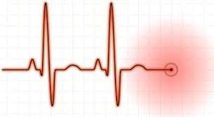 Пострадавшие при обрушении навеса на «Дордое» все еще находятся в реанимации