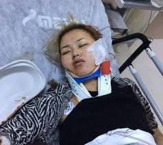 Кыргызстанка которая находится в коме была продана в сексуальное рабство в Турции