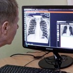 Тяжелые формы туберкулеза в Кыргызстане будут лечить по-новому