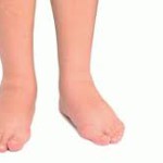 Наводнение в организме