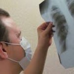 В Бишкеке все чаще диагностируют туберкулез у детей — Буюклянов