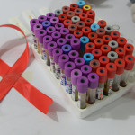 В Африке нашли девочку, победившую ВИЧ