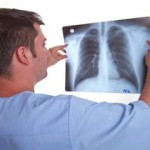 Туберкулезным больным больше не будут оплачивать проезд за счет бюджета