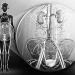 ЗАБОЛЕВАНИЯ МОЧЕПОЛОВОЙ СИСТЕМЫ КАМНИ В ПОЧКАХ