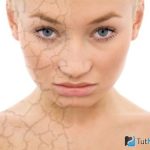 Помощь при сухости и шелушении кожи