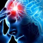 Нарушение мозгового кровообращения