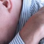 Как лечить старческий зуд кожи народными средствами