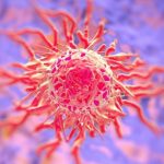 4 симптома, которые могут проявляться за 5 лет до рака