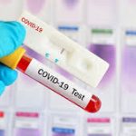 За сутки в КР выявлено 877 случаев COVID-19 и внебольничной пневмонии.