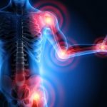 3 народных средства для лечения артроза суставов