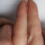 3 простых способа проверки лёгких на коронавирус