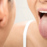 Пустыня на языке: о каких заболеваниях предупреждает сухость во рту