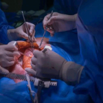 Установлен порядок услуг по трансплантации