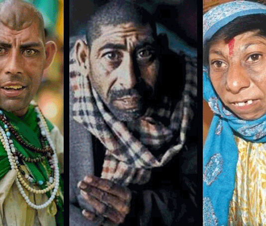 «Люди-крысы» Шах-Даулы