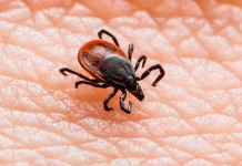 Тошнота, рвота и судороги: чем опасны весенние клещи