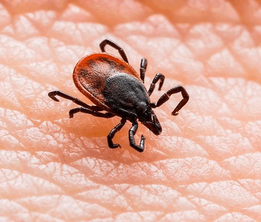 Тошнота, рвота и судороги: чем опасны весенние клещи